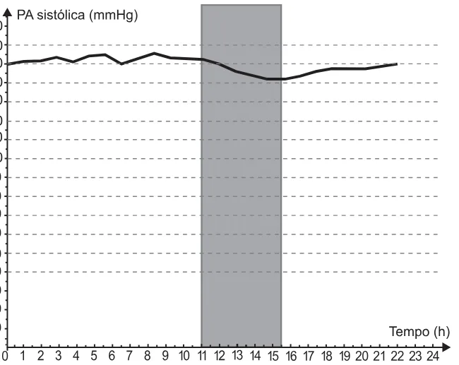 Alternativa E da questão 178 do ENEM 2021 - 2º Dia – Caderno 6 – Cinza – Reaplicação/PPL/Segunda Oportunidade.
