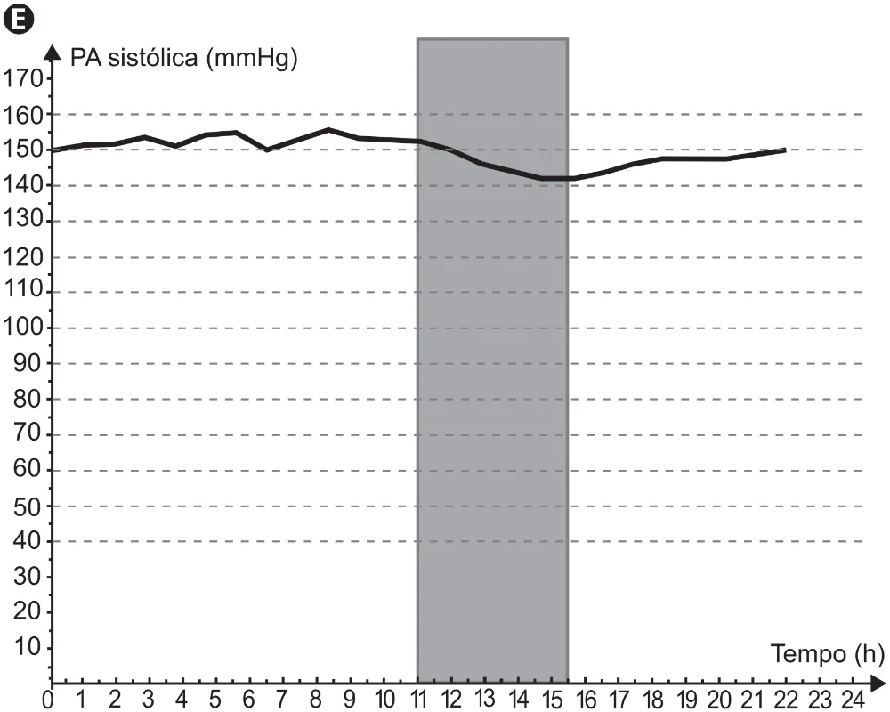 Gráfico completo da alternativa E da questão 153 do ENEM 2021.