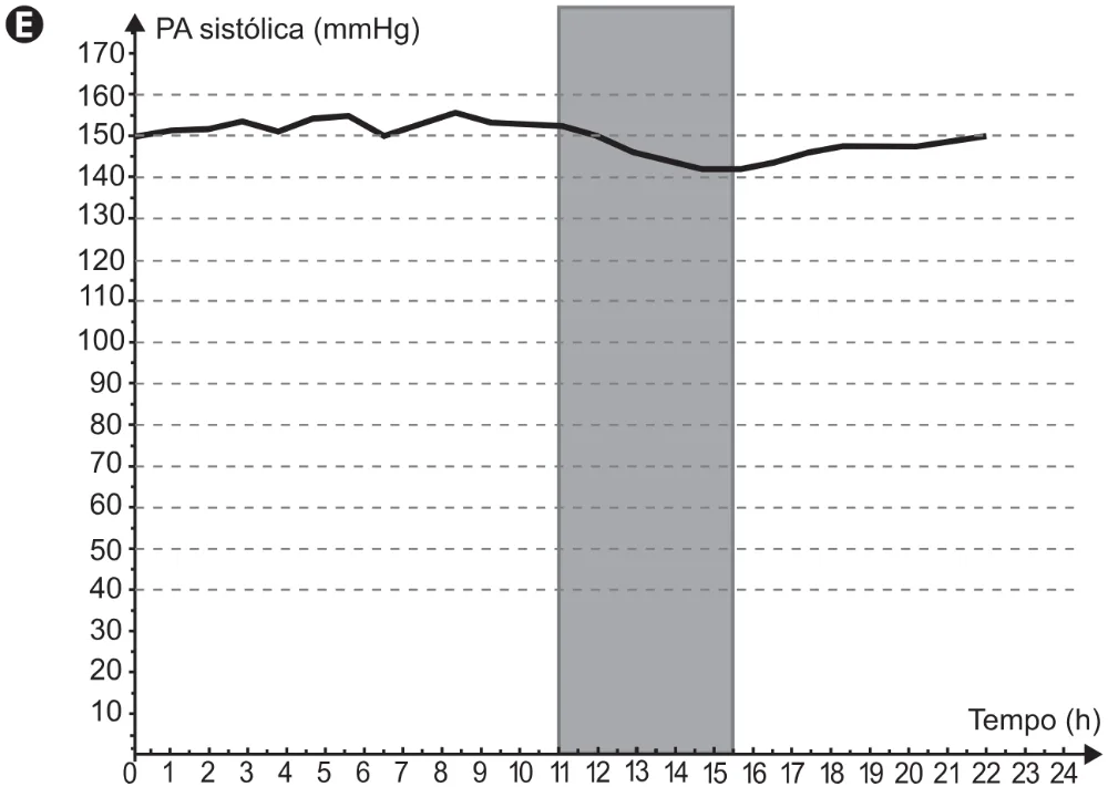 Gráfico completo da alternativa E da questão 153 do ENEM 2021.