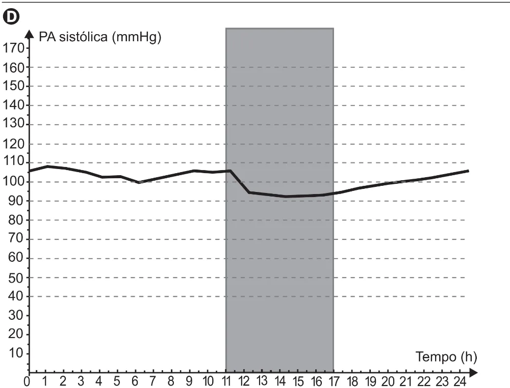 Gráfico completo da alternativa D da questão 153 do ENEM 2021.