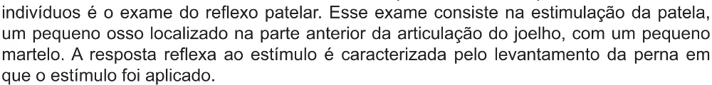 Trecho original com figura, tabela ou fórmula da questão 125 do ENEM 2021 - 2º Dia – Caderno 12 – Verde (Libras – Ampliada) – Aplicação Regular.