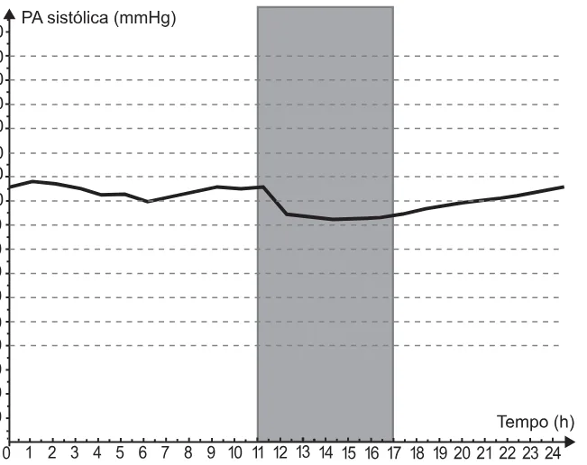 Alternativa D da questão 166 do ENEM 2021 - 2º Dia – Caderno 8 – Rosa – Reaplicação/PPL/Segunda Oportunidade.